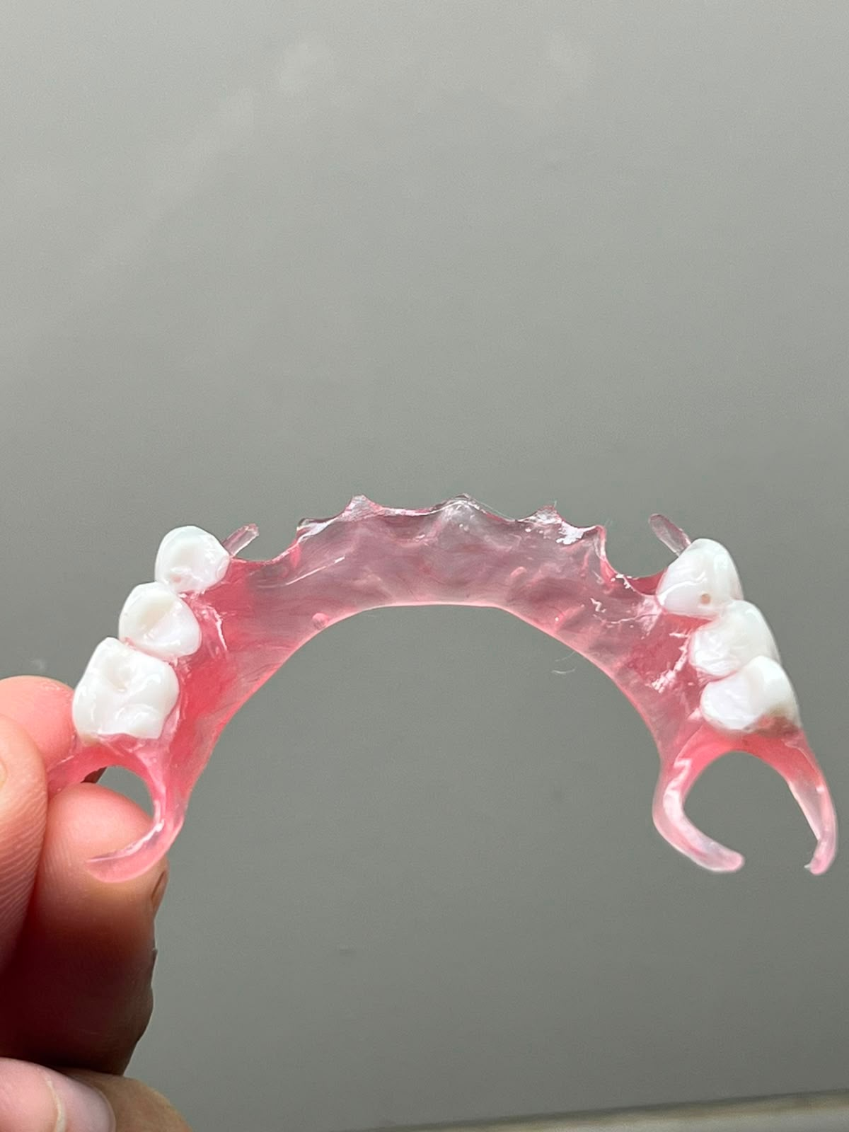 Prótese parcial removível flexível rosa